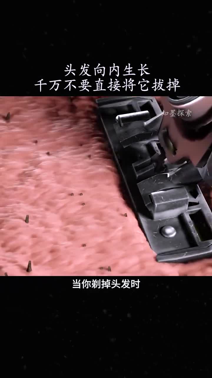 头发逆向生长该怎么办