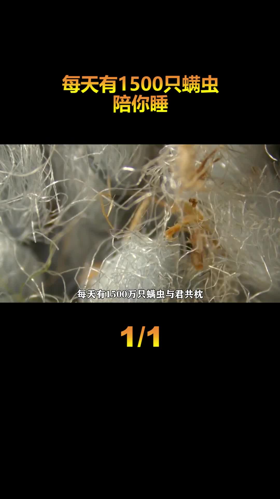 毛囊里的异形1500只螨虫陪你睡吃喝拉撒全在你脸上