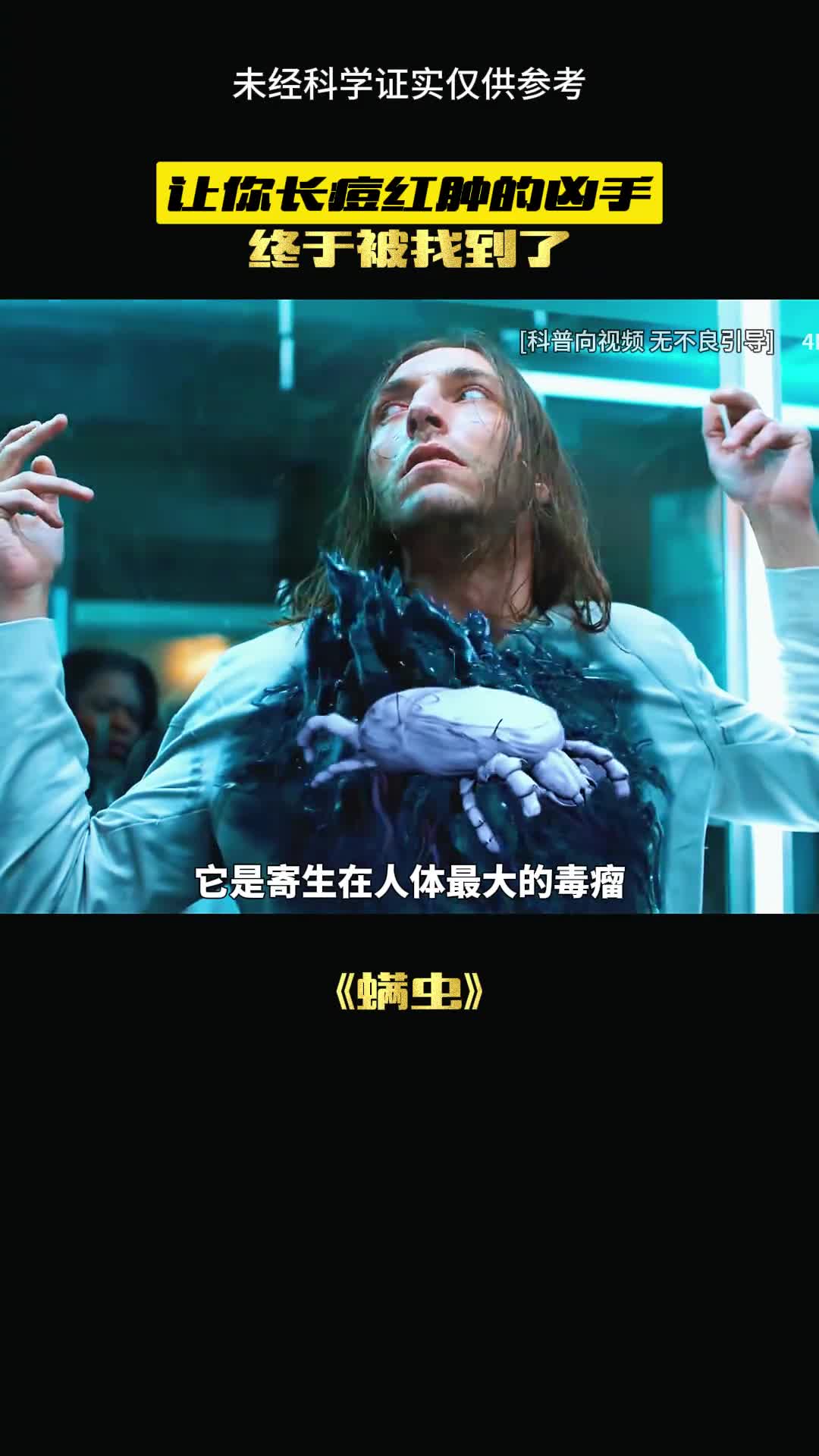 这种寄生生物有多恐怖