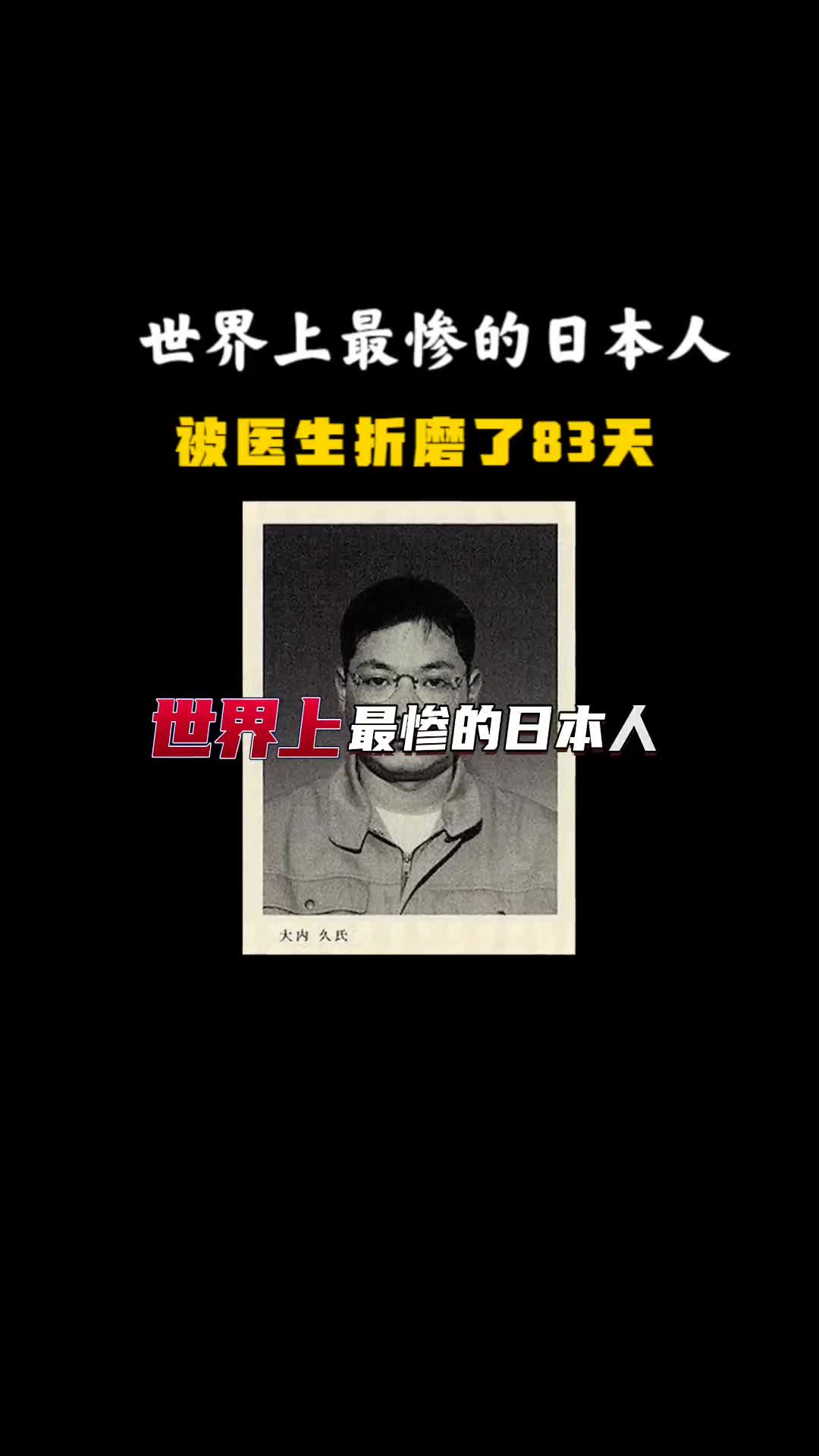 世界上最惨的日本人被医生折磨了83天看着自己的身体腐烂