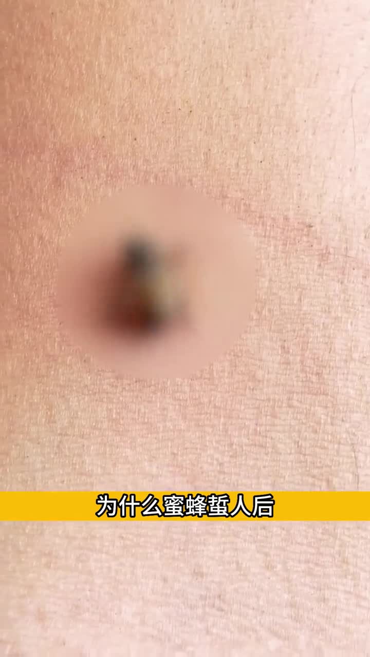 为什么蜜蜂蜇人后就会挂掉