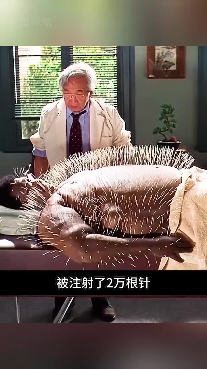 这个胖子的身体被注射了2万根针