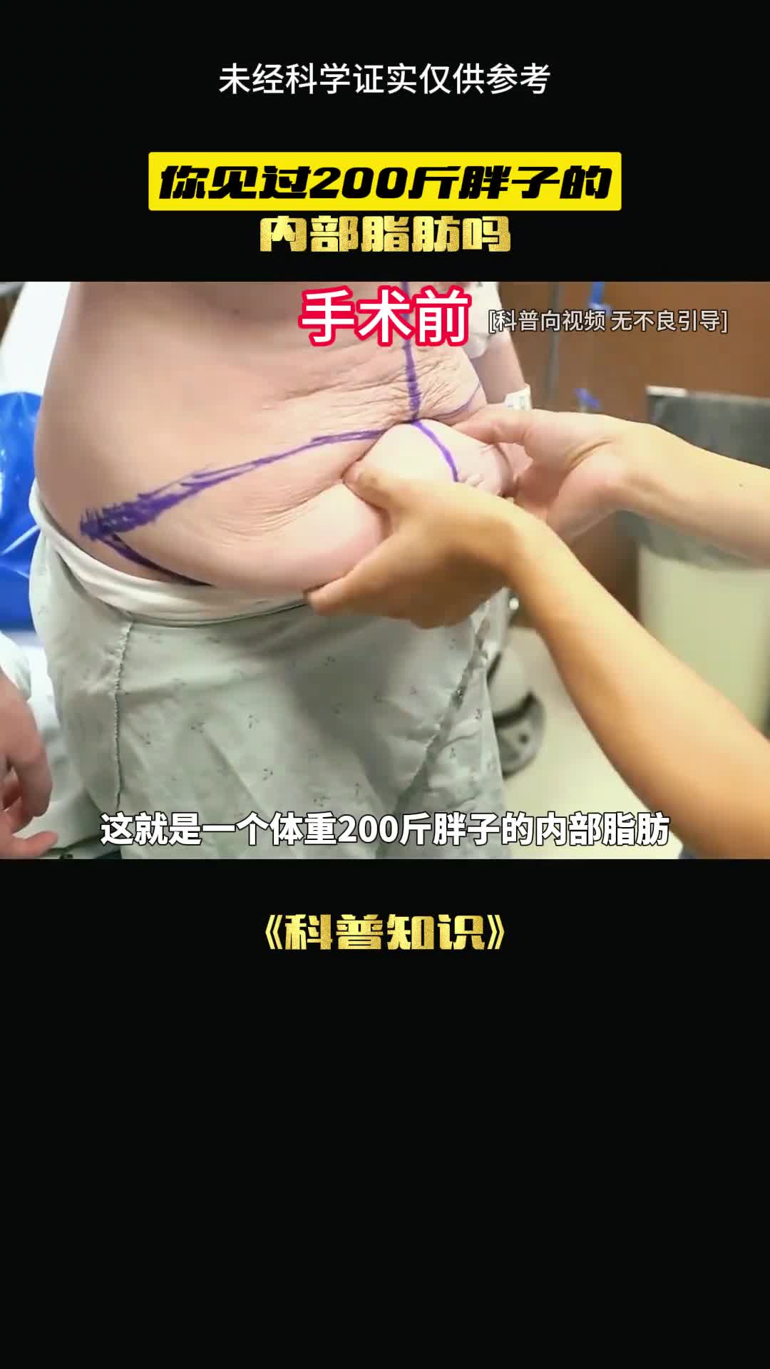 这是最真实的皮下脂肪影像