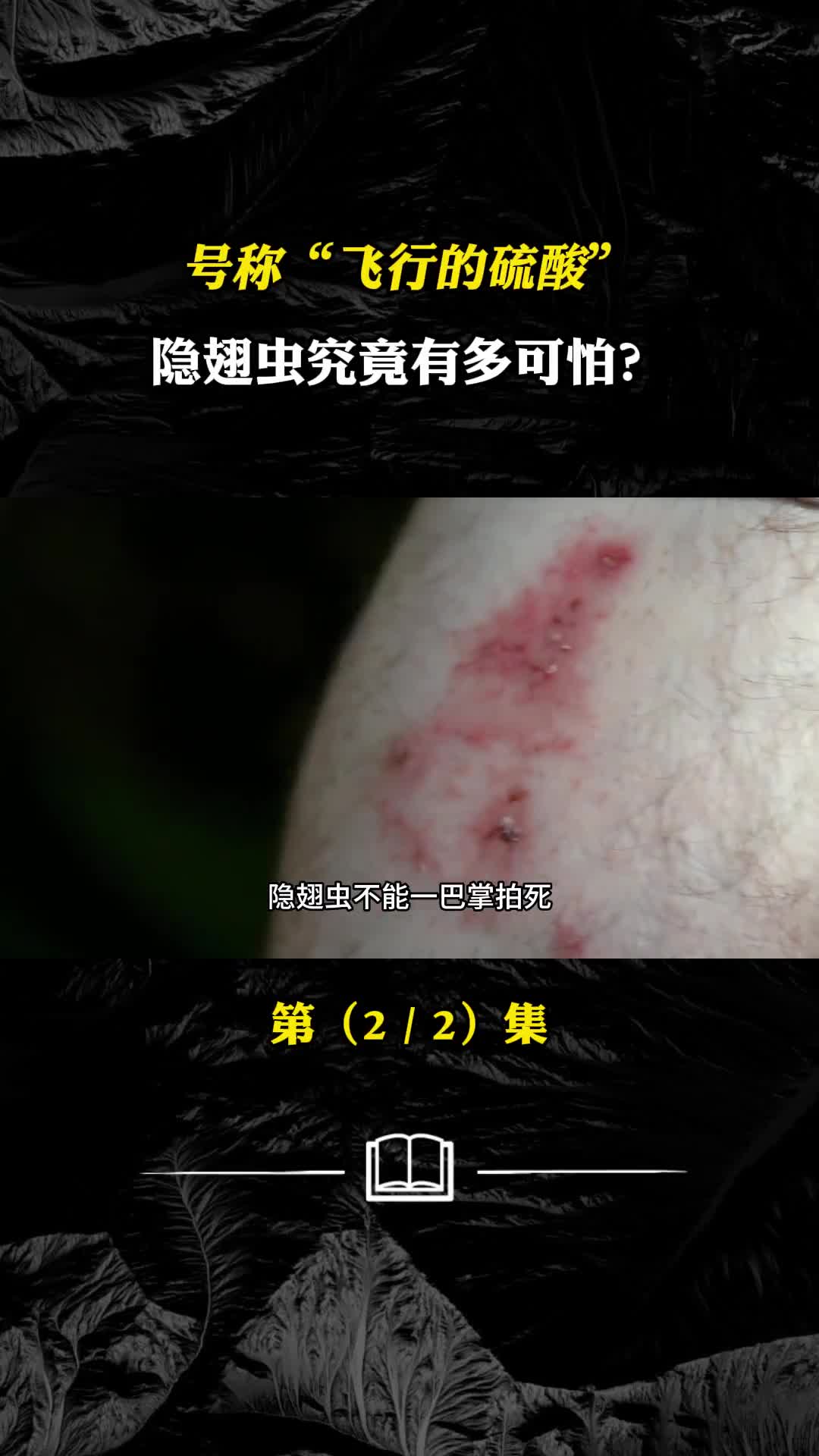 号称飞行的硫酸隐翅虫究竟有多可怕遇到千万不能拍打