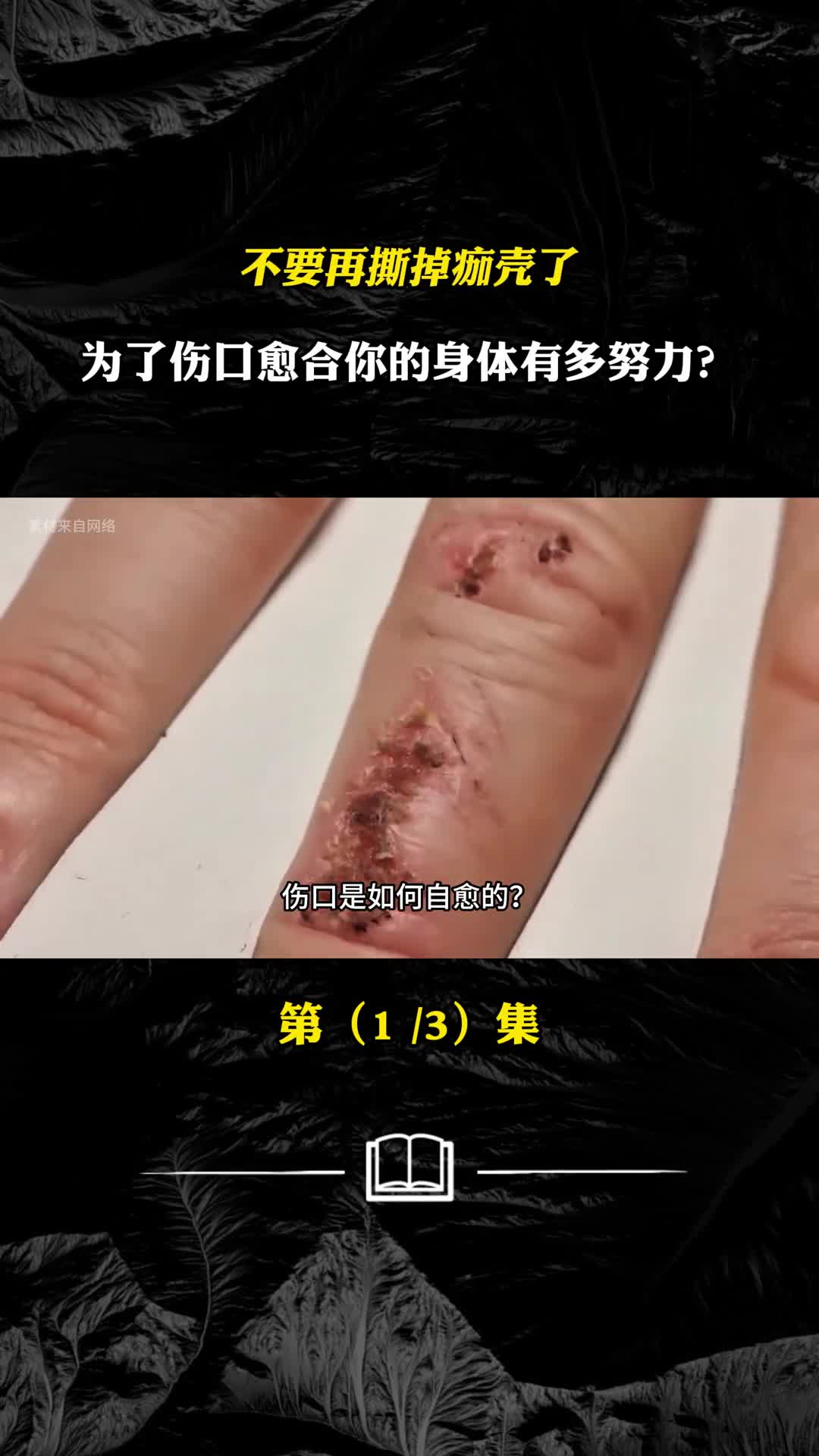 不要再撕掉痂壳了为了伤口愈合你的身体有多努力