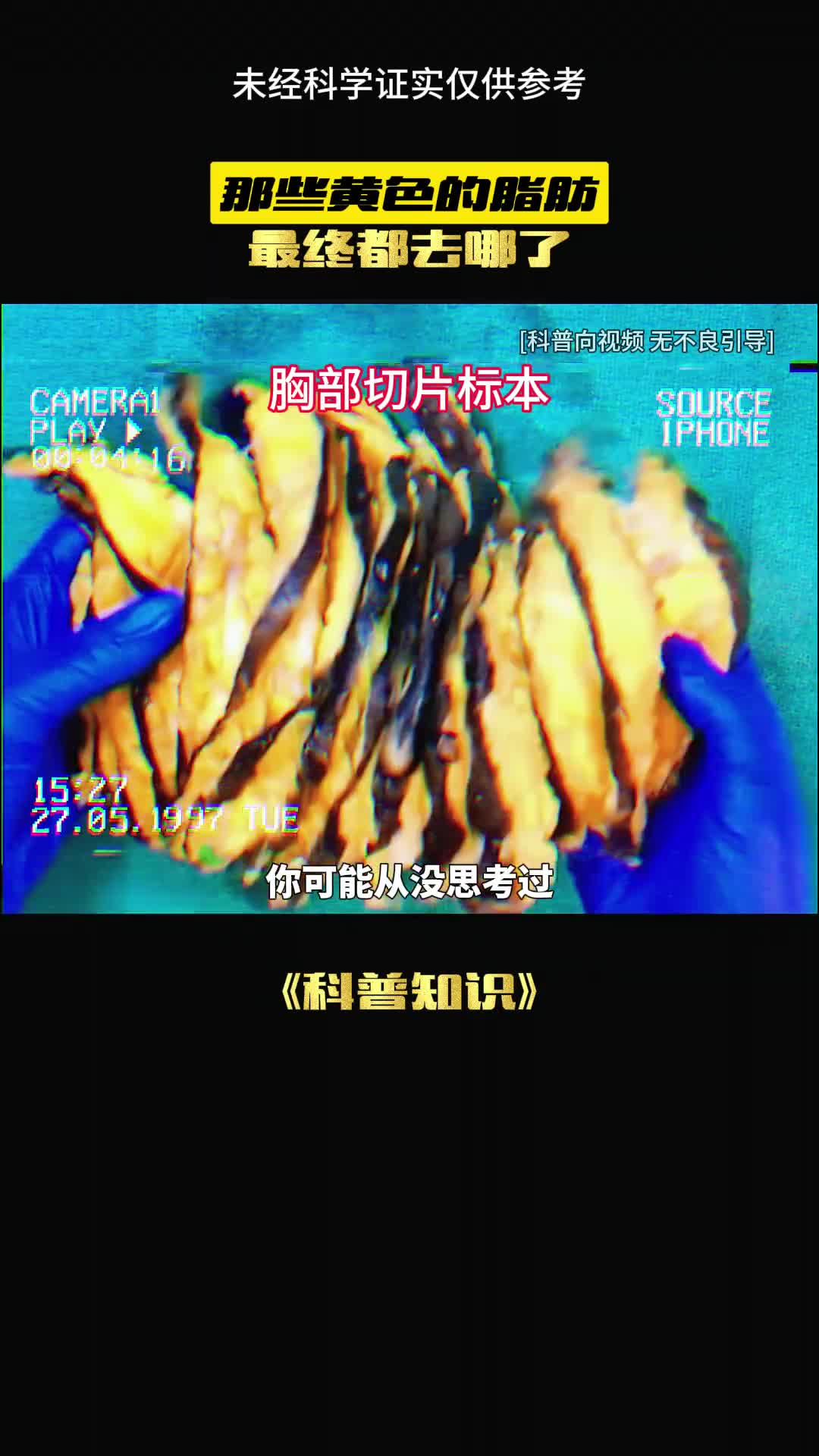 这才是真正的皮下脂肪录像