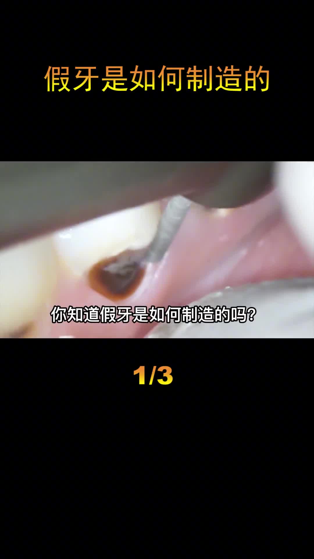 假牙是如何制造的成本不到几十块钱的陶瓷假牙却要卖到上千块