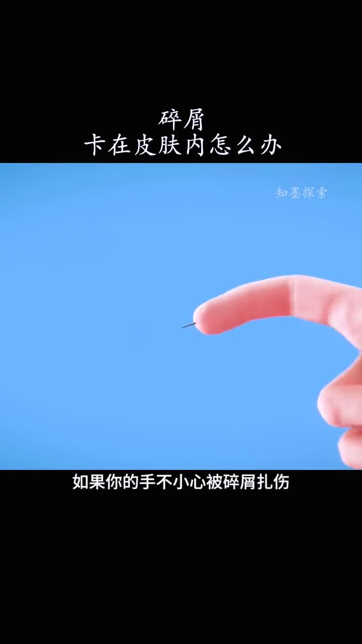 木碎屑会长在皮肤内吗