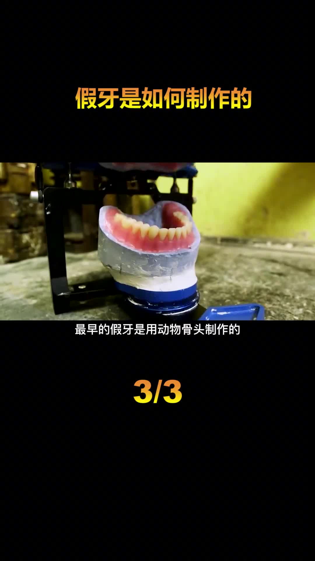 假牙是如何制作的