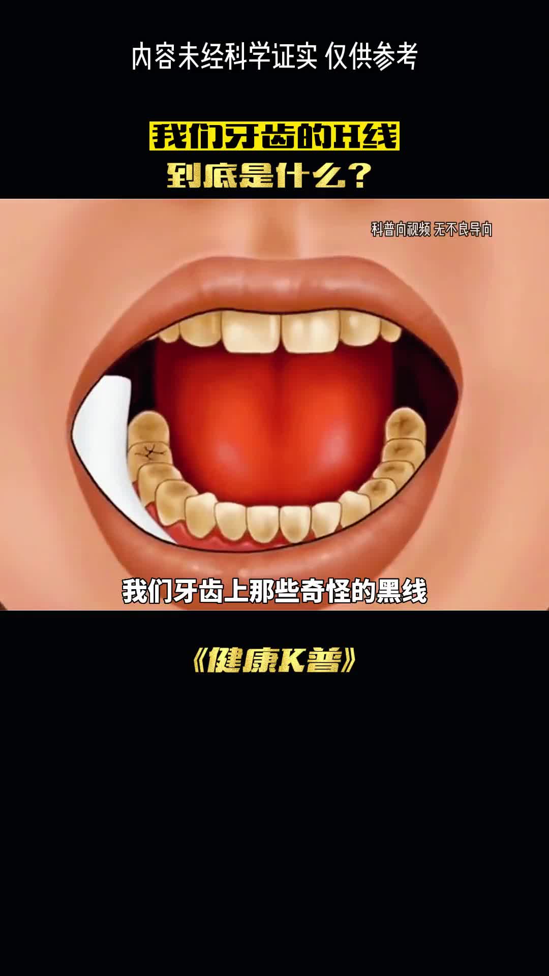 牙齿上的黑线到底是什么