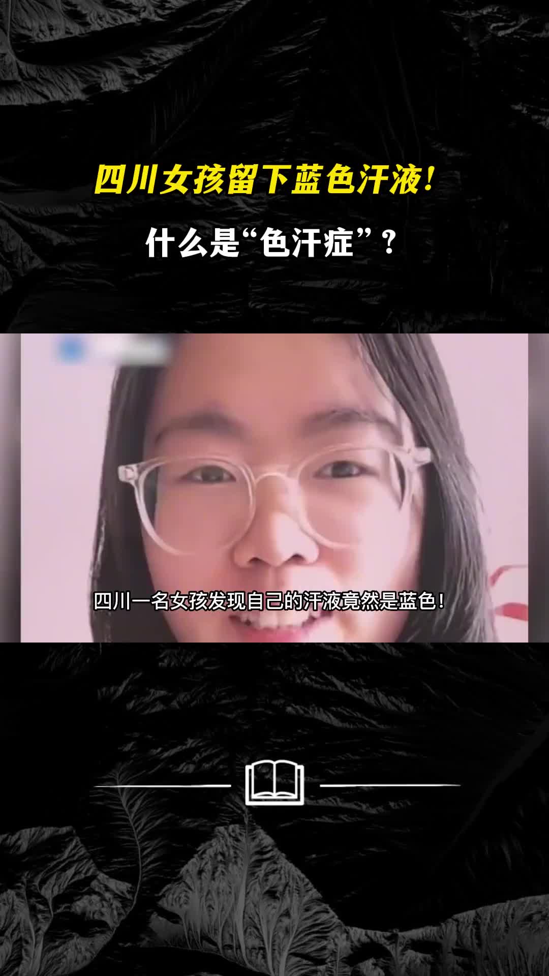 四川女孩留下蓝色汗液什么是色汗症它有什么危害呢