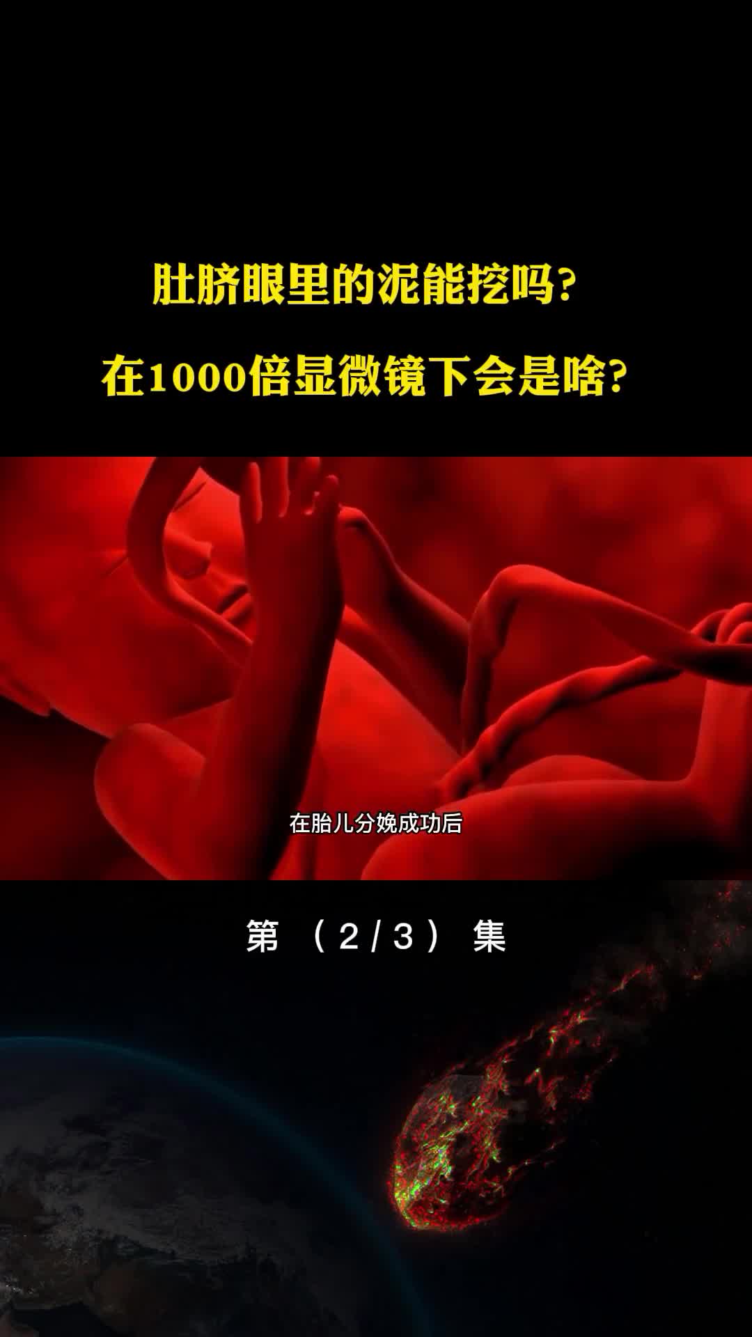 肚脐眼里的泥能挖吗在1000倍显微镜下会是啥看后让人震惊