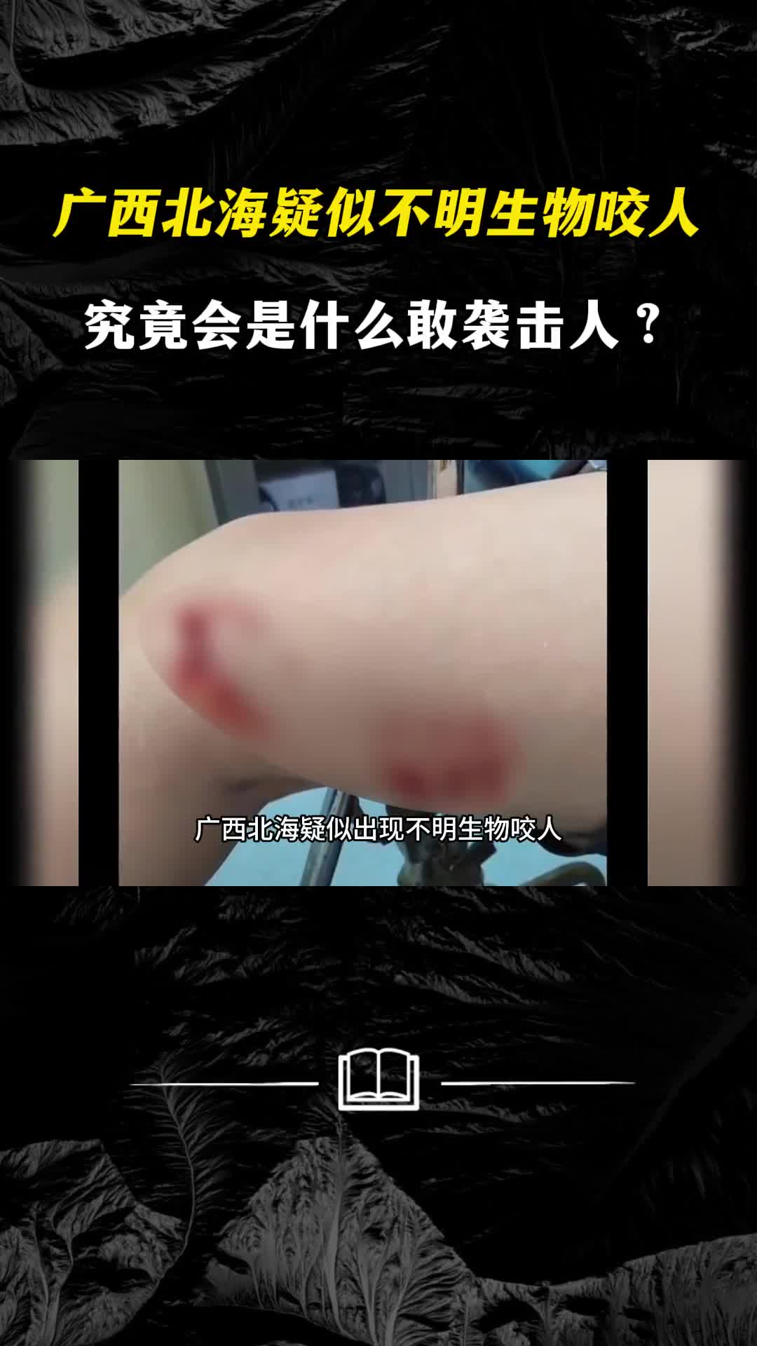 广西北海疑似出现不明生物咬人究竟会是什么敢袭击人