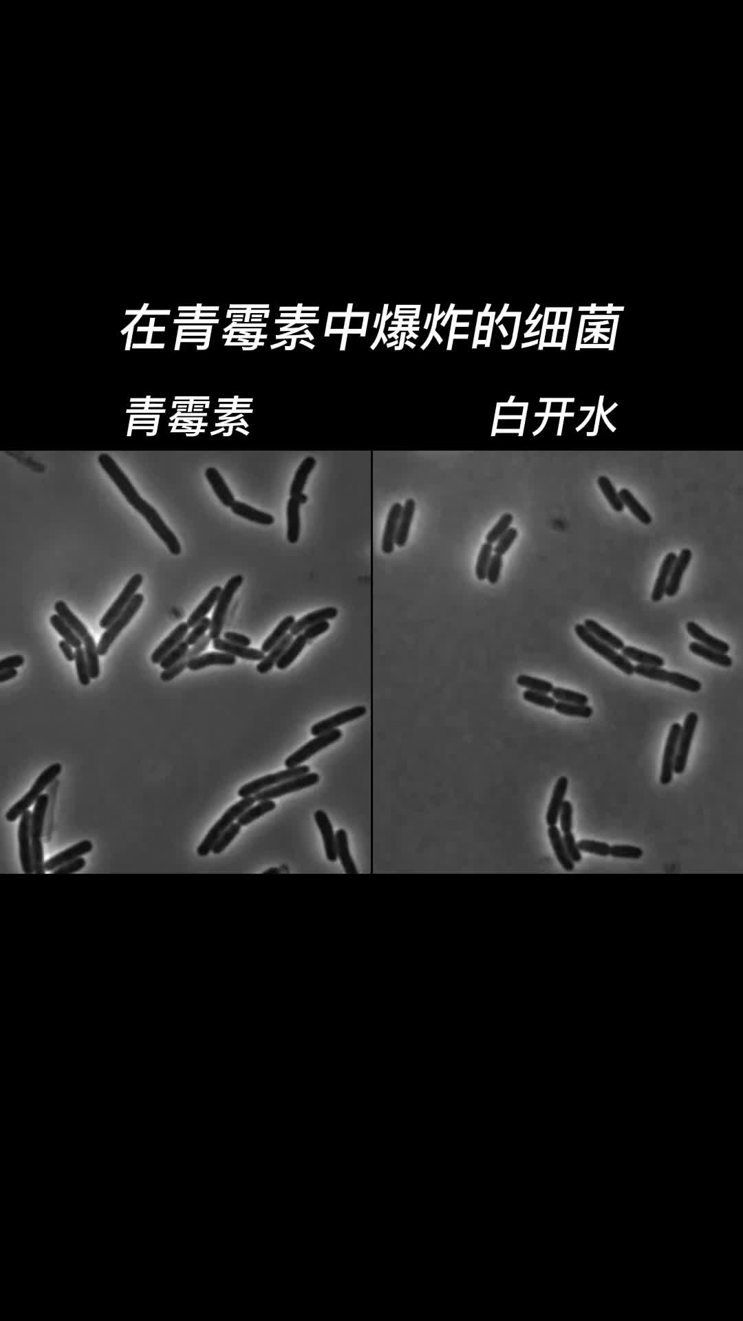 青霉素靠干扰细菌细胞壁合成让细菌渗透压失衡吸水过多炸裂阿门