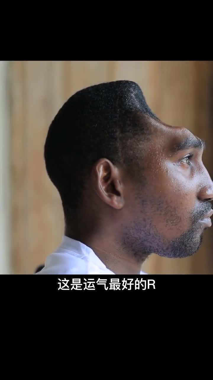 只剩下半个脑袋奇迹活了下来