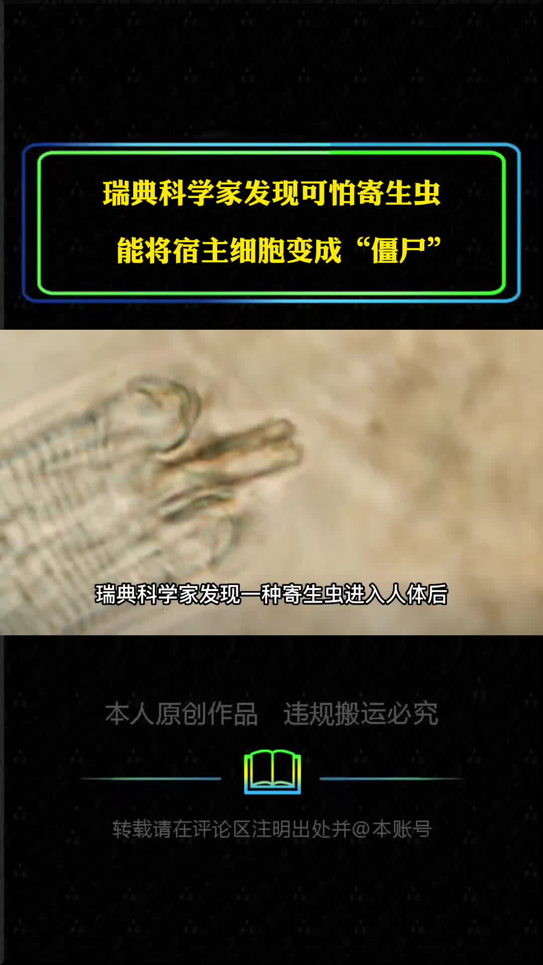 瑞典科学家发现寄生虫能将宿主细胞变成僵尸全球有20亿人感染