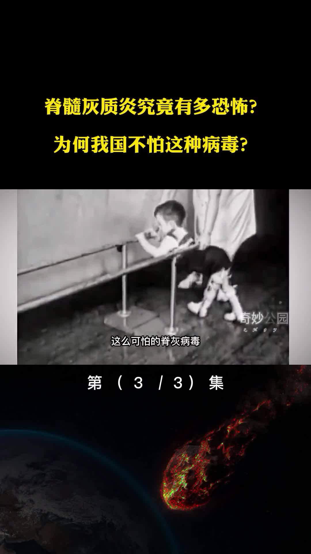 脊髓灰质炎究竟有多恐怖为何我国不怕这种病毒我们要感谢他