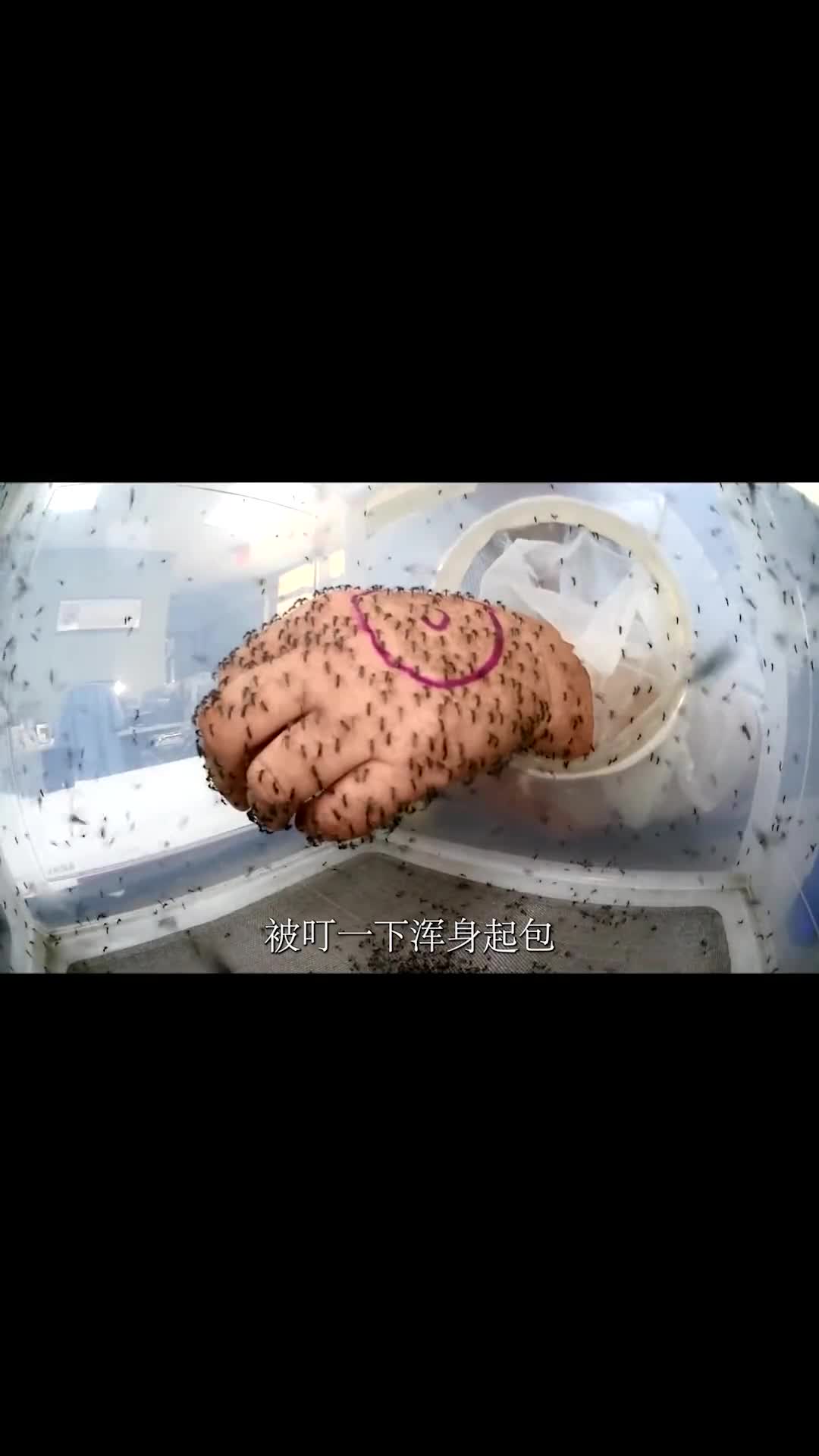 如果你总是被蚊子叮咬那可能是你没找对方法千万要注意了这样才能不被蚊子咬