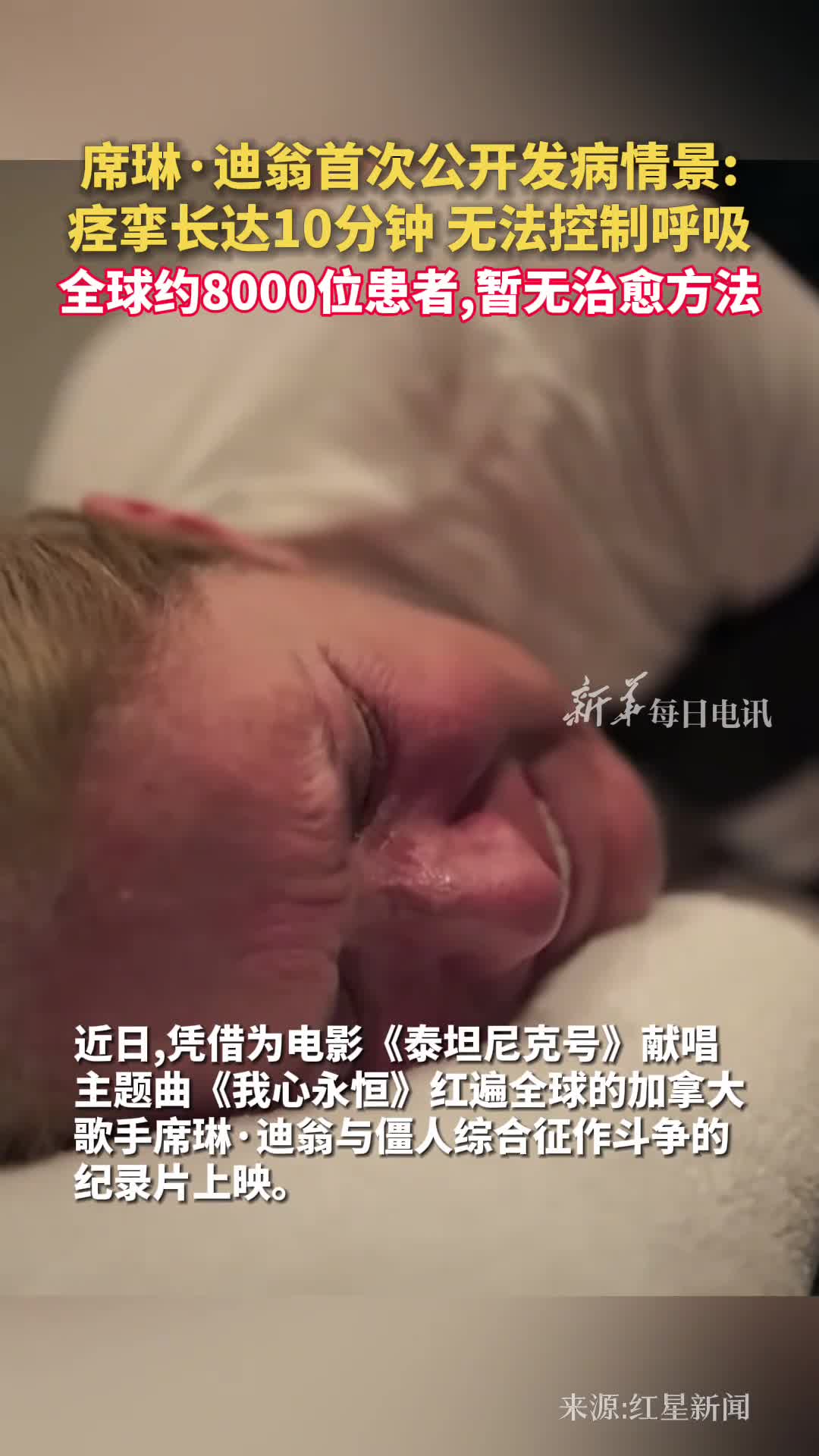 席琳迪翁首次公开发病情景痉挛长达10分钟无法控制呼吸全球约8000位患者暂无治愈方法