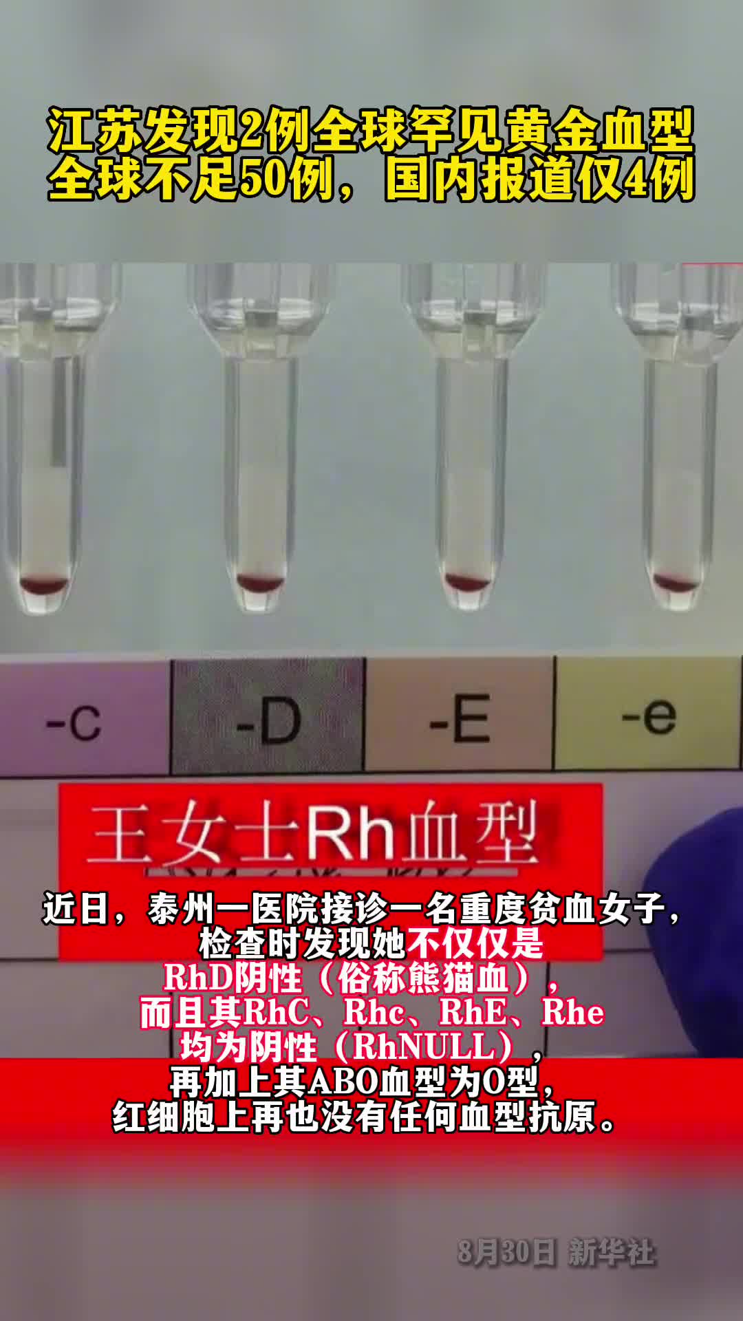 江苏发现2例全球罕见黄金血型概率是六百万分之一