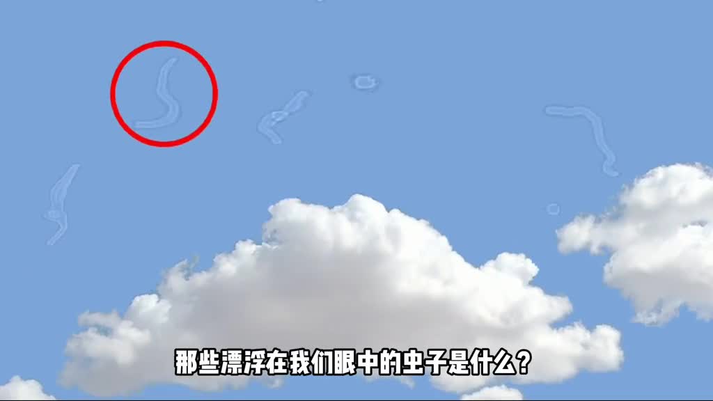 那些飘浮在我们眼中的虫子是什么它在你还未出生时就有了