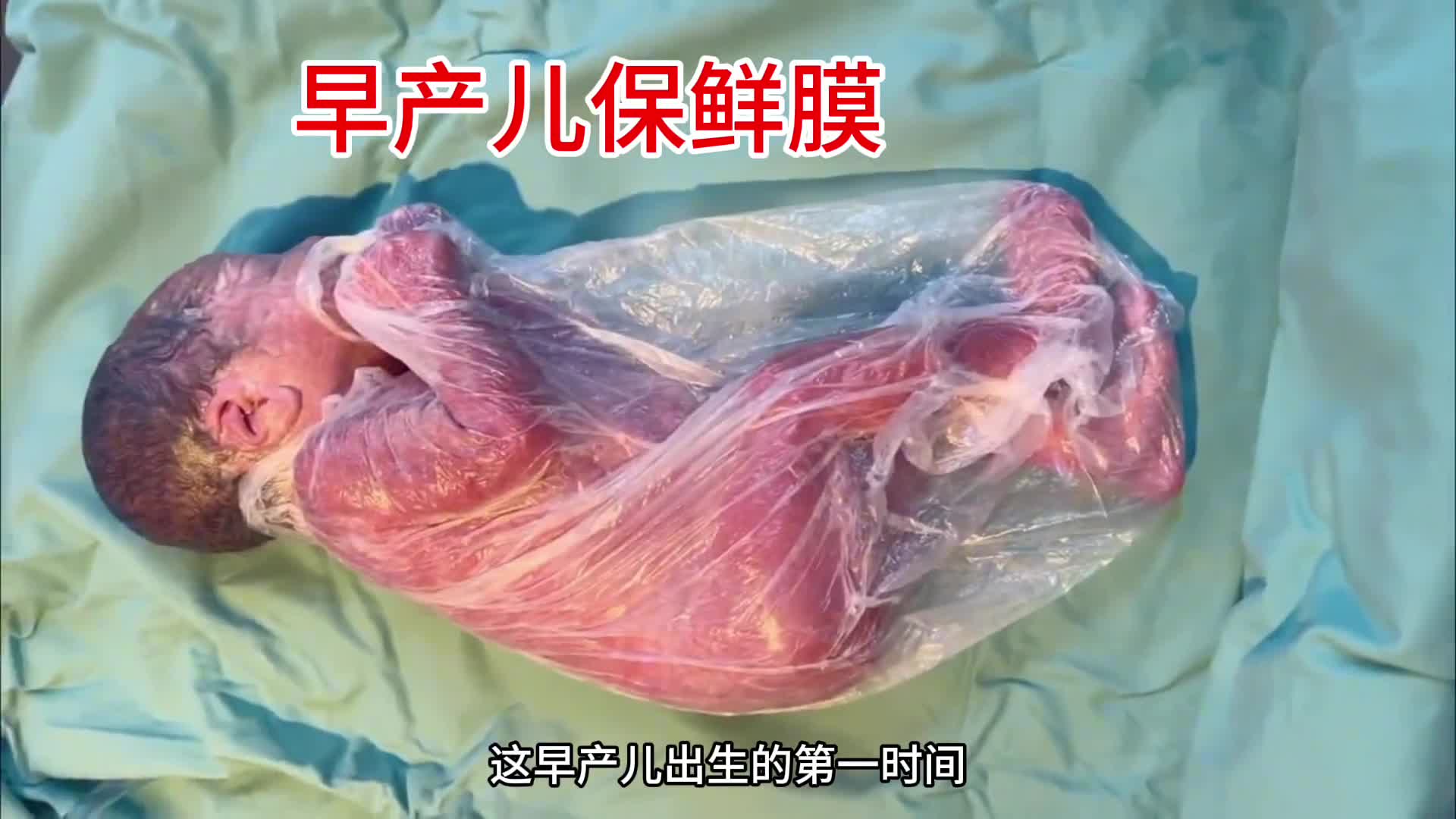 早产儿为啥要裹保鲜膜