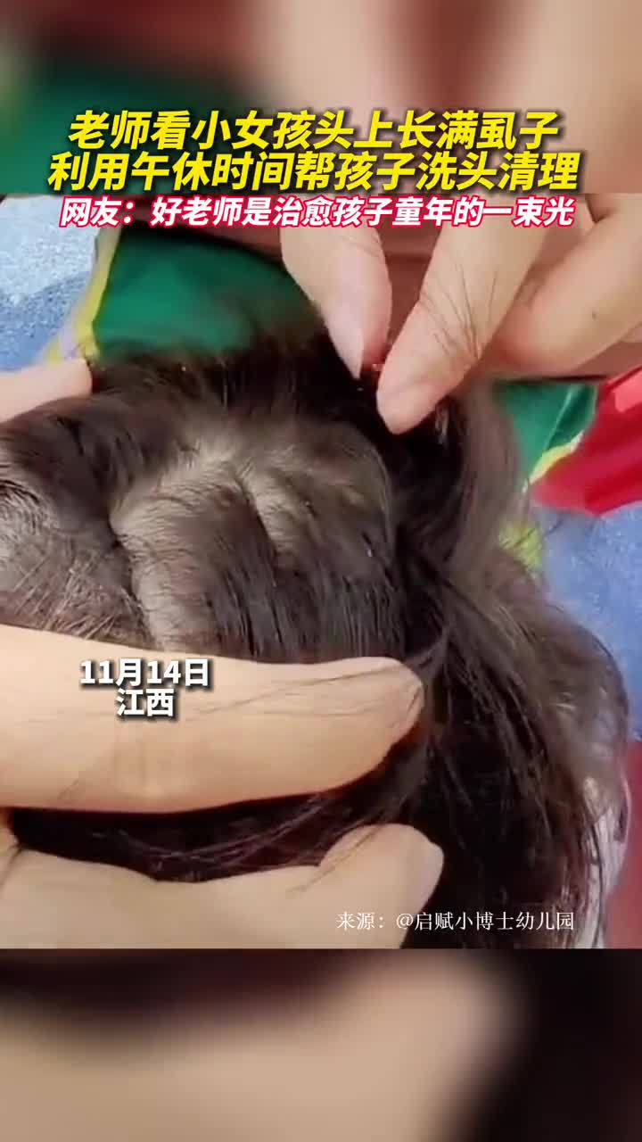 老师看小女孩头上长满虱子利用午休时间帮孩子洗头清理