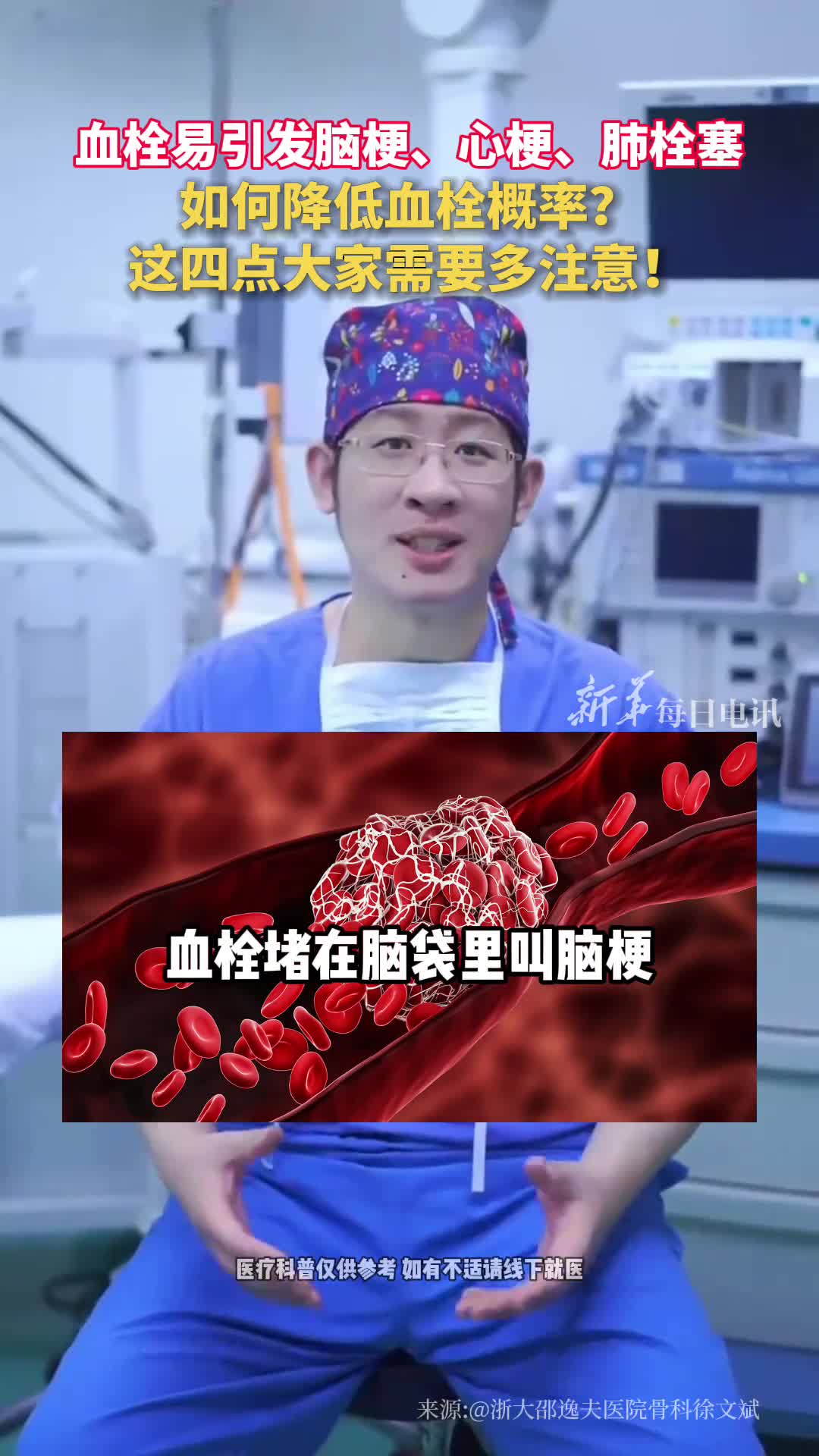 血栓易引发脑梗心梗肺栓塞如何降低血栓概率这四点大家需要多注意