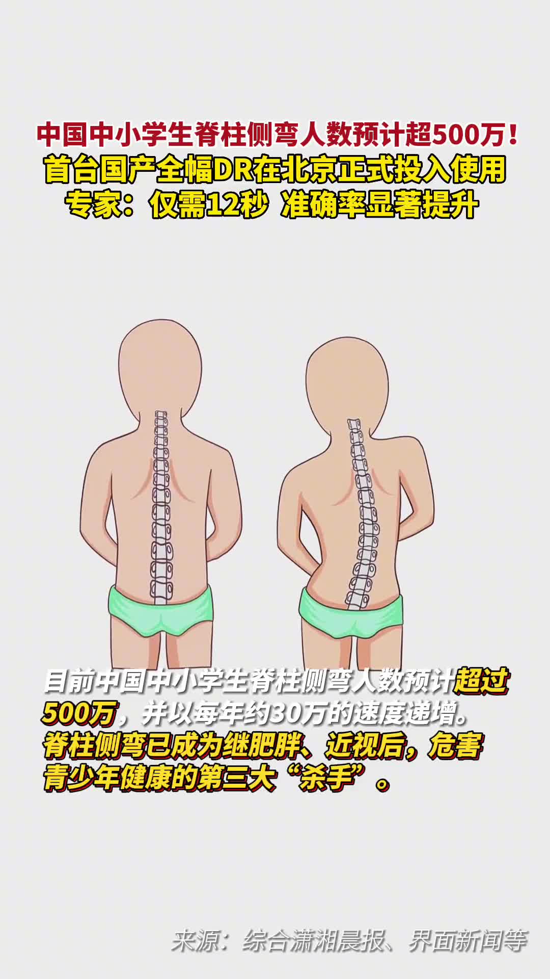 首台国产全幅DR在北京正式投入使用