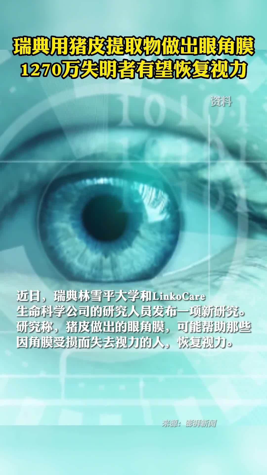 瑞典用猪皮提取物做出眼角膜1270万失明者有望恢复视力