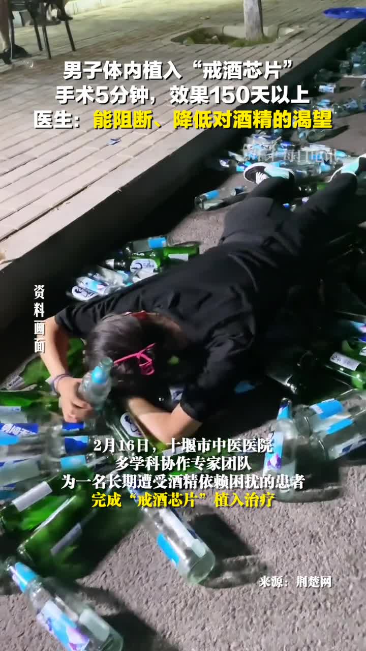 男子体内植入戒酒芯片手术5分钟效果150天以上医生说能阻断降低对酒精的渴望