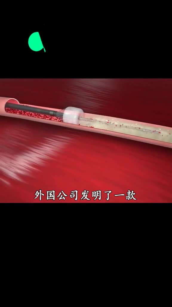 真希望以后这个技术普及