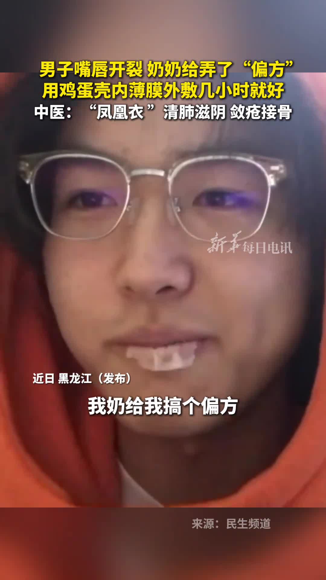 男子嘴唇开裂奶奶给弄了偏方用鸡蛋壳内薄膜外敷几小时就好中医凤凰衣清肺滋阴敛疮接骨