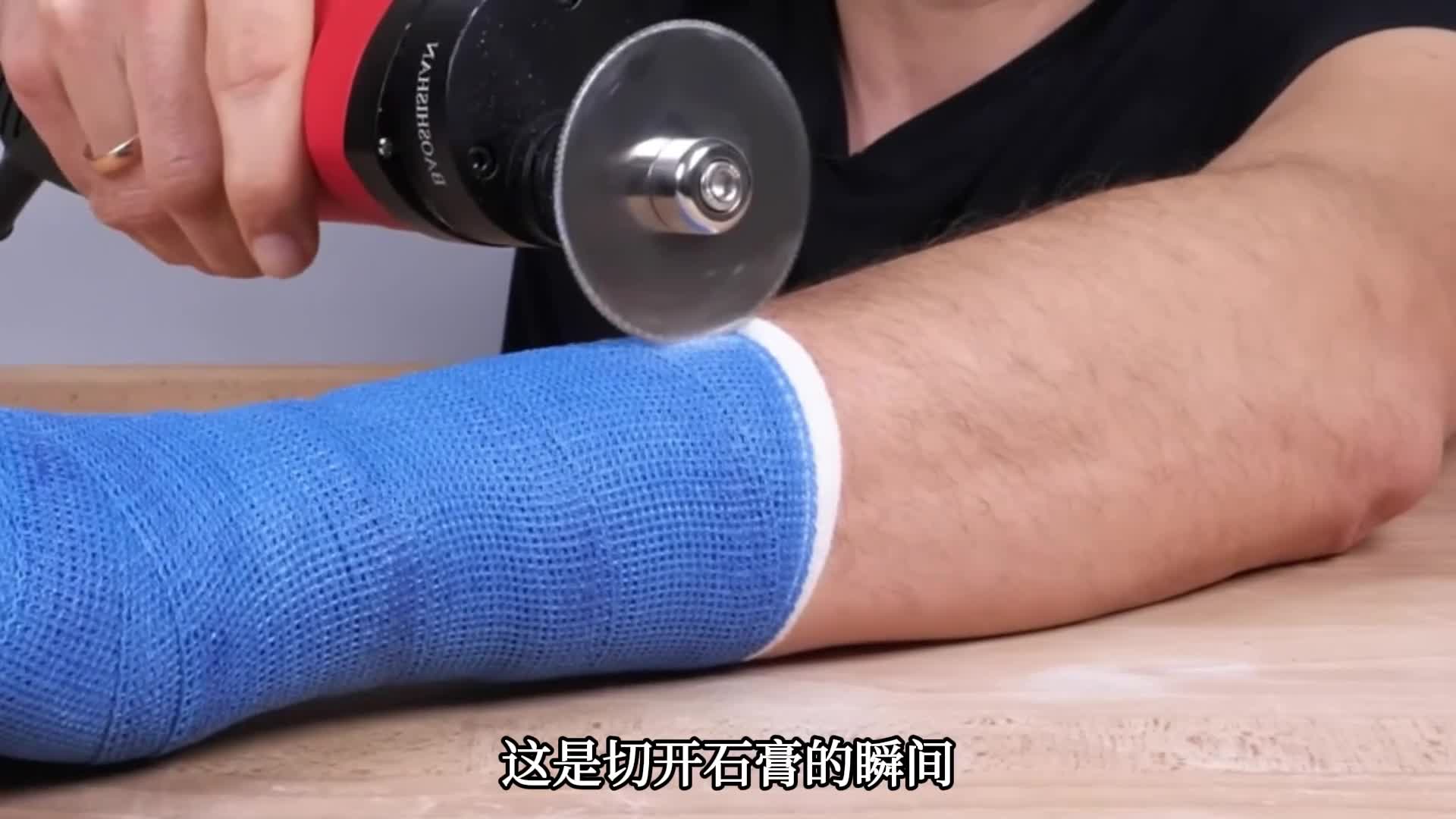 鬼才发明为什么石膏锯切到皮肤也没事背后的原理太巧妙了