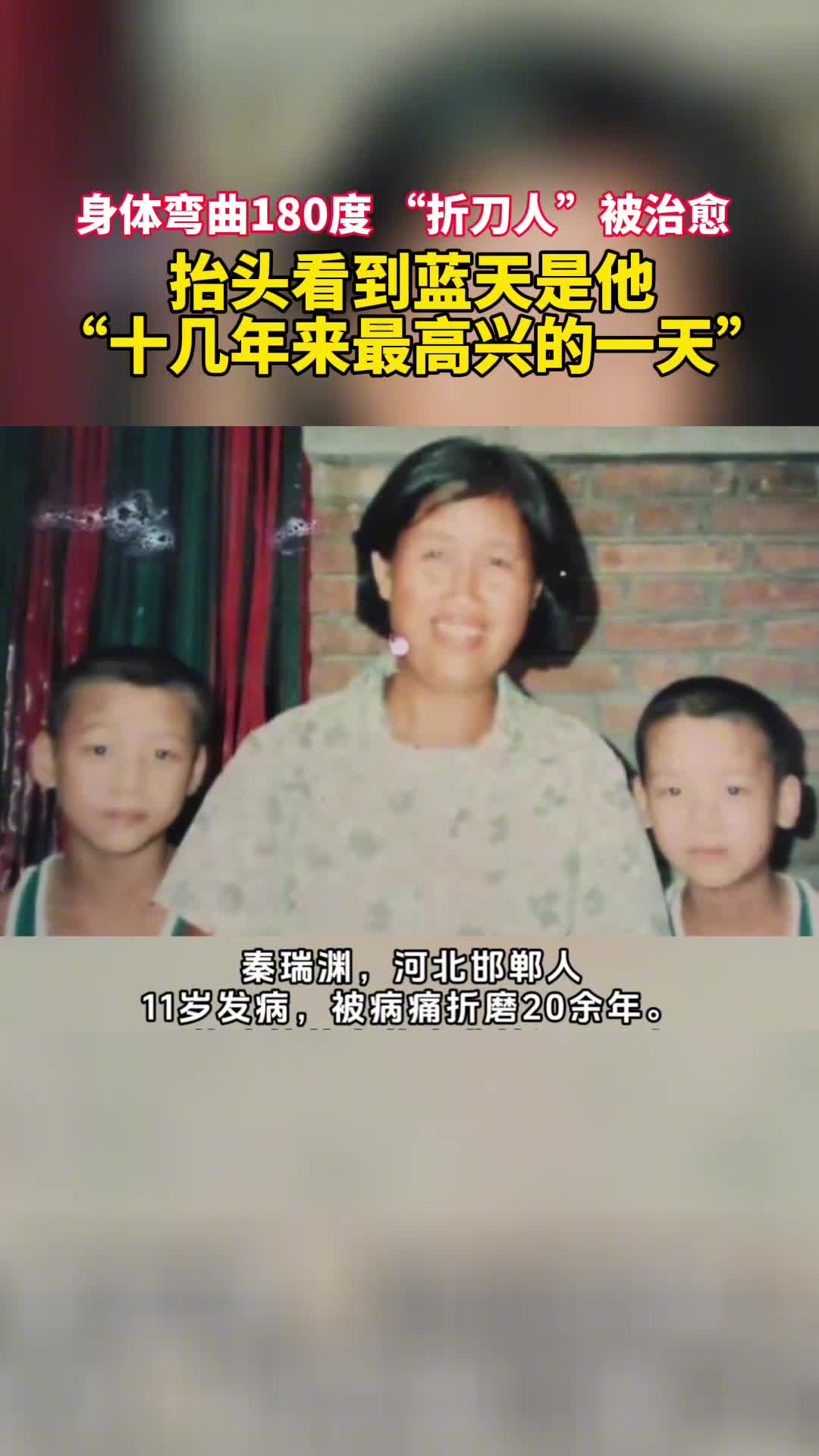身体弯曲180度折刀人被治愈抬头看到蓝天是他十几年来最高兴的一天