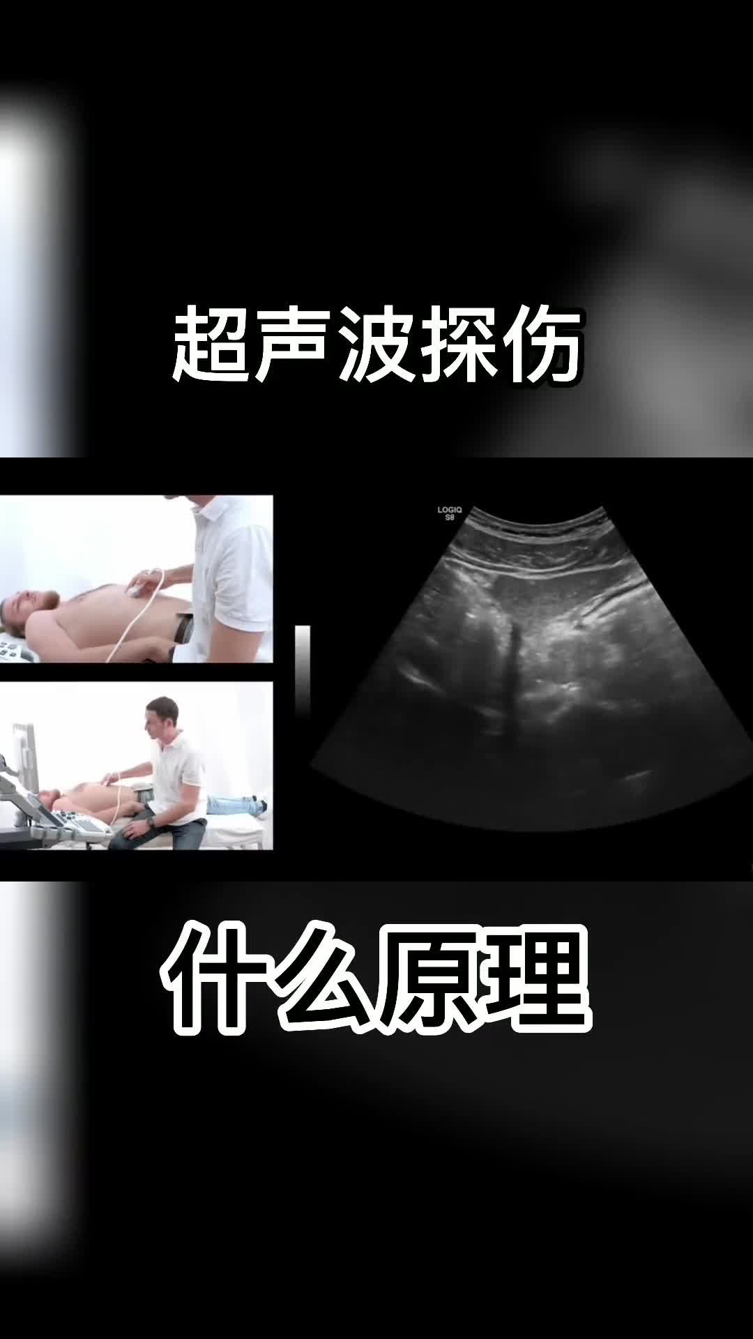 超声波探伤是什么原理探头放上去有趣的现象发生了