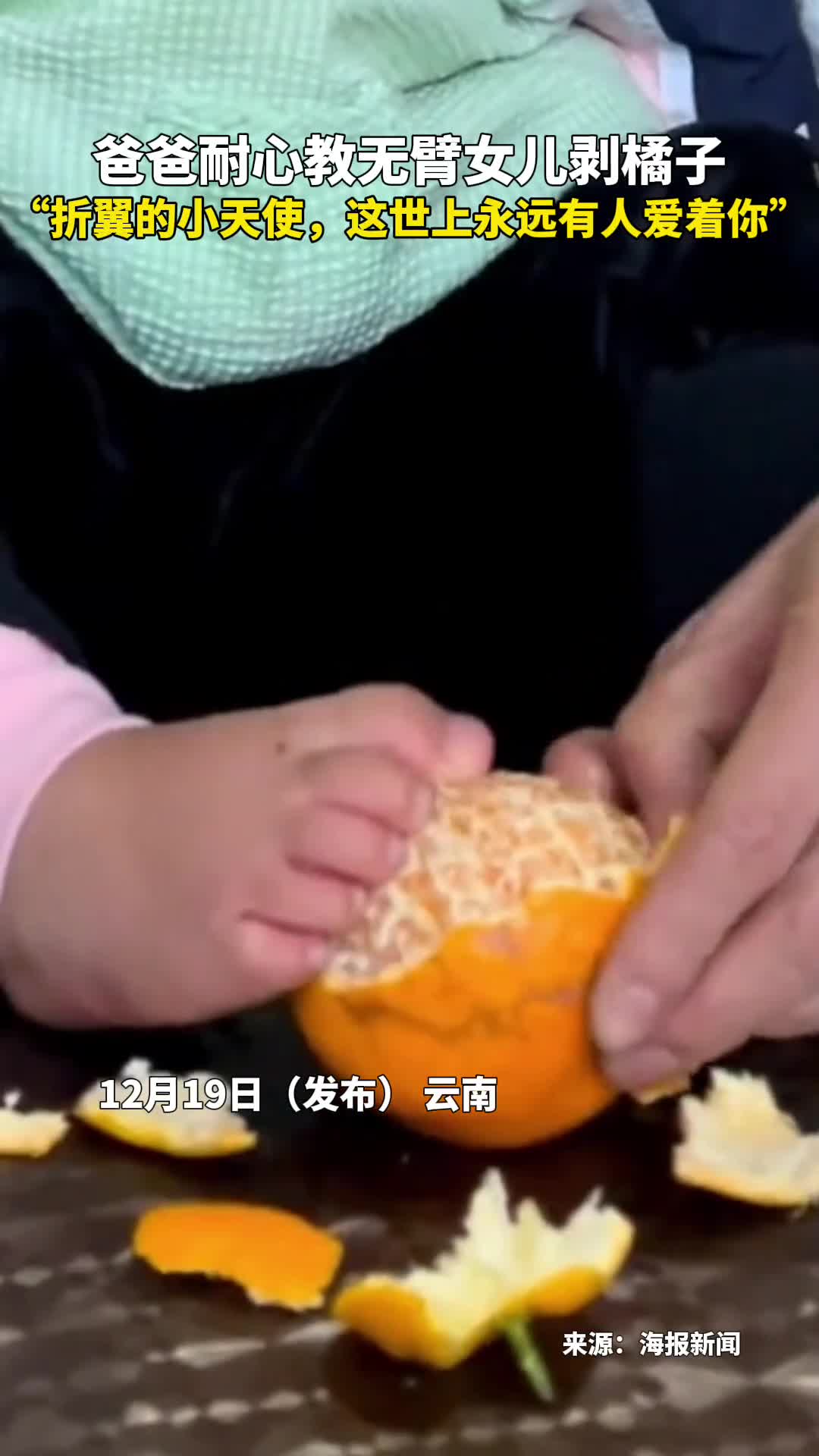 爸爸耐心教无臂女儿剥橘子折翼的小天使这世上永远有人爱着你