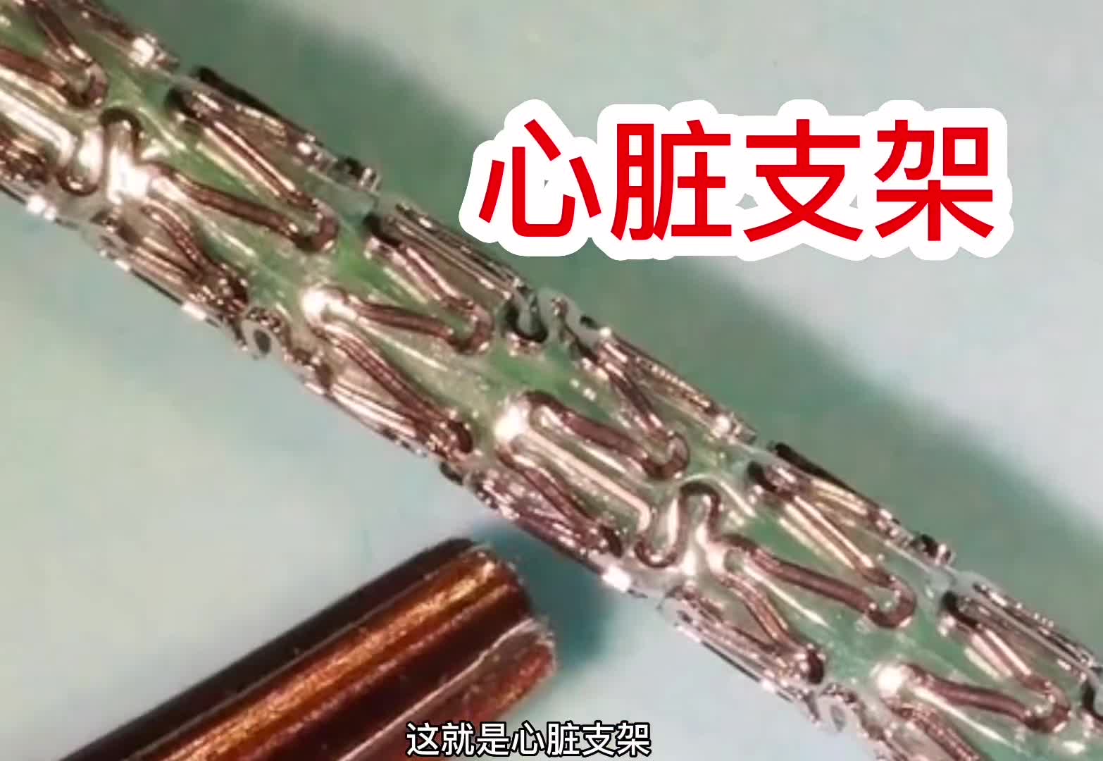 心脏支架长这样