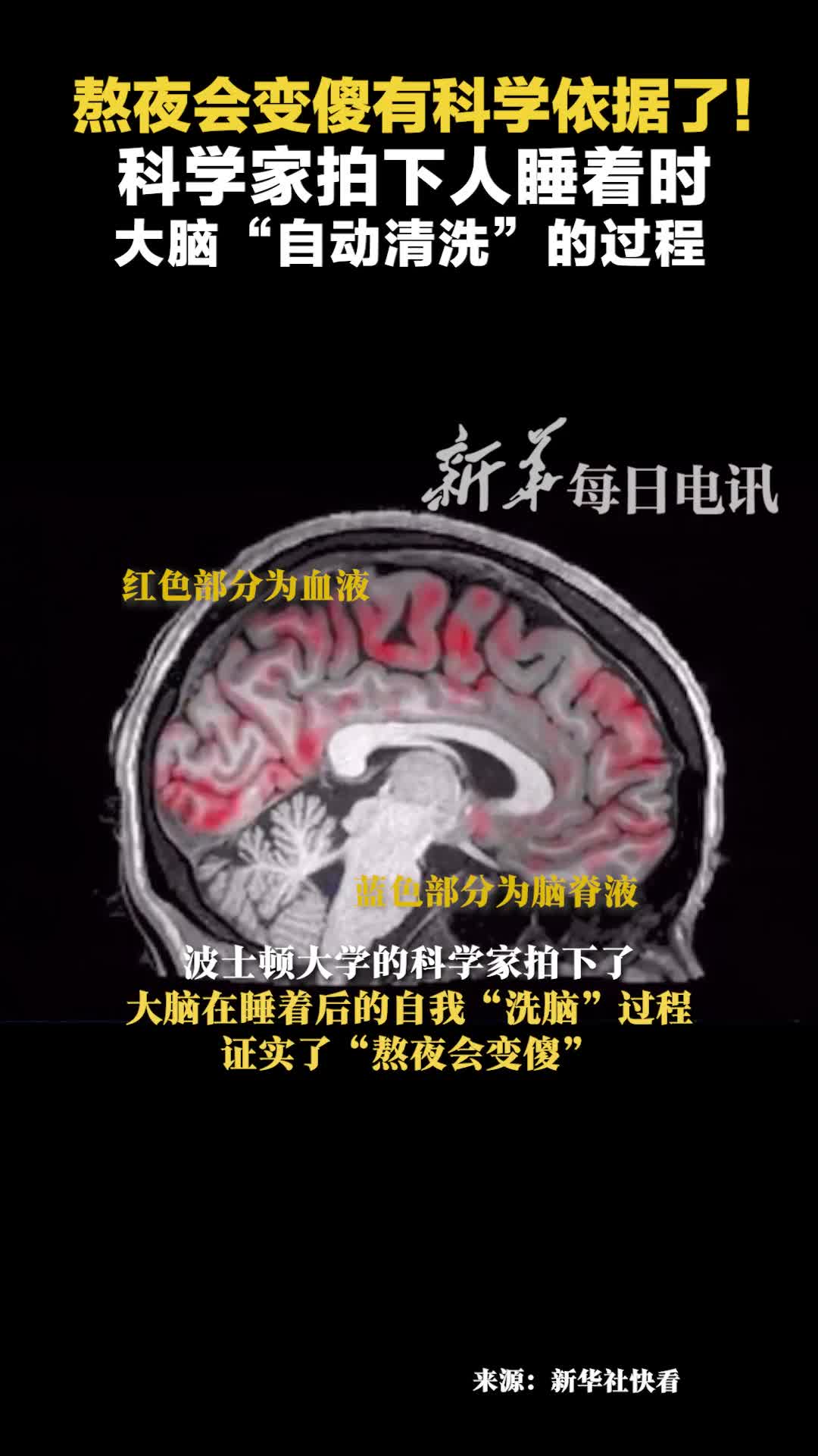 熬夜会变傻有科学依据了科学家拍下人睡着时大脑自动清洗的过程
