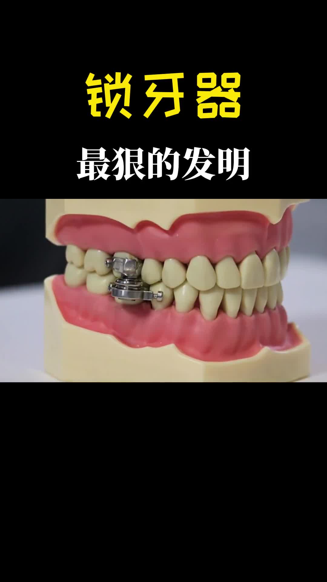 锁牙器堪称史上最狠发明