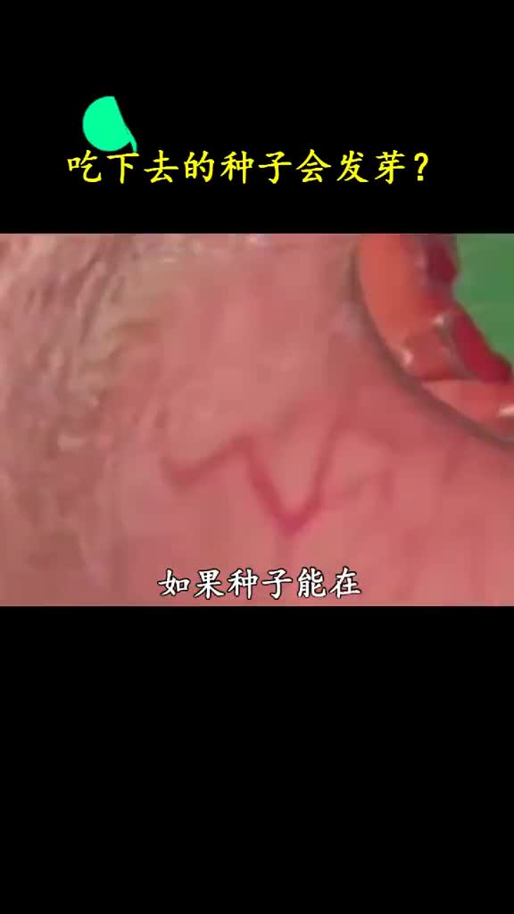 如果吃进肚子里的种子发芽该怎么办