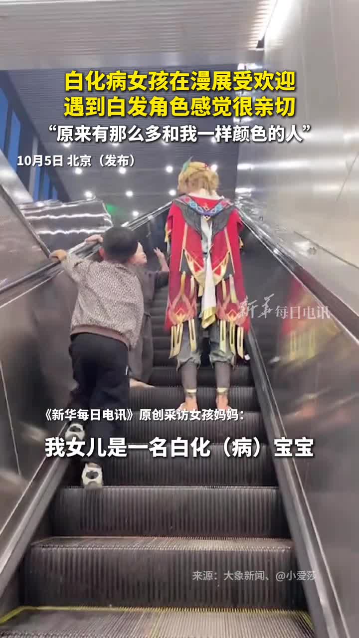 白化病女孩在漫展受欢迎遇到白发角色感觉很亲切原来有那么多和我一样颜色的人小爱莎