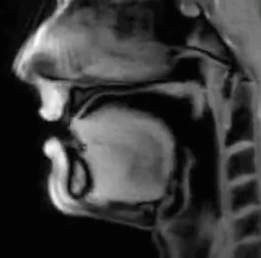 磁共振扫描人说话时的样子猜猜他说的啥抖音小助手
